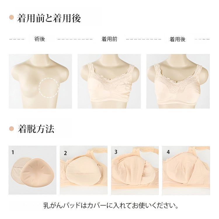 人工乳房 着脱方法